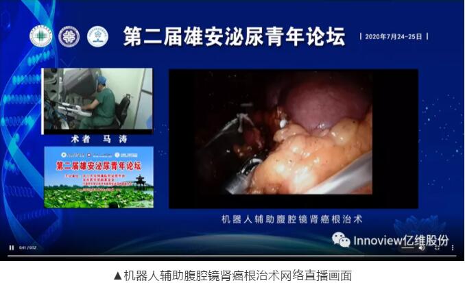 億維遠(yuǎn)程示教系統(tǒng)完美助力雄安泌尿青年論壇手術(shù)演示